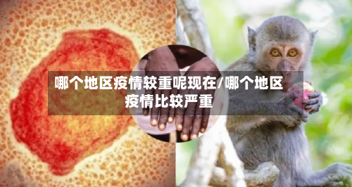 哪个地区疫情较重呢现在/哪个地区疫情比较严重-第3张图片