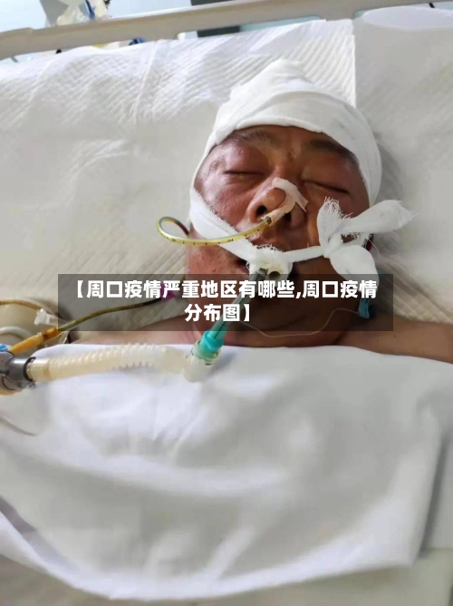 【周口疫情严重地区有哪些,周口疫情分布图】
